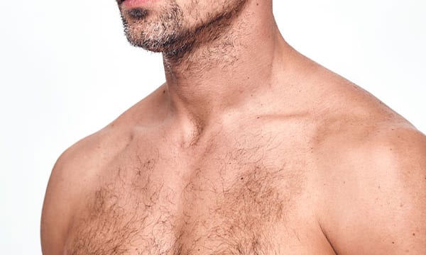 Male Areola Reduction